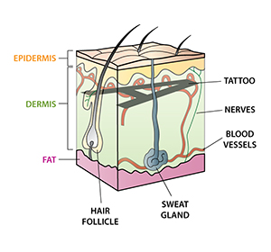 Aesthetic Laser Clinic » Laser Tattoo Removal